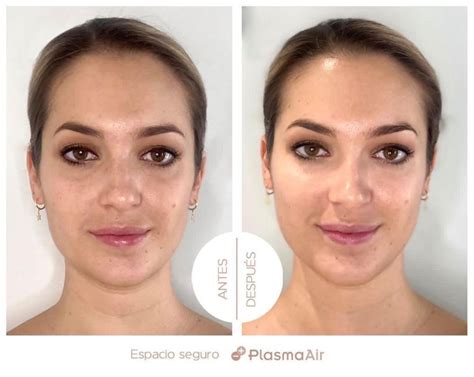 antes y después de la limpieza facial